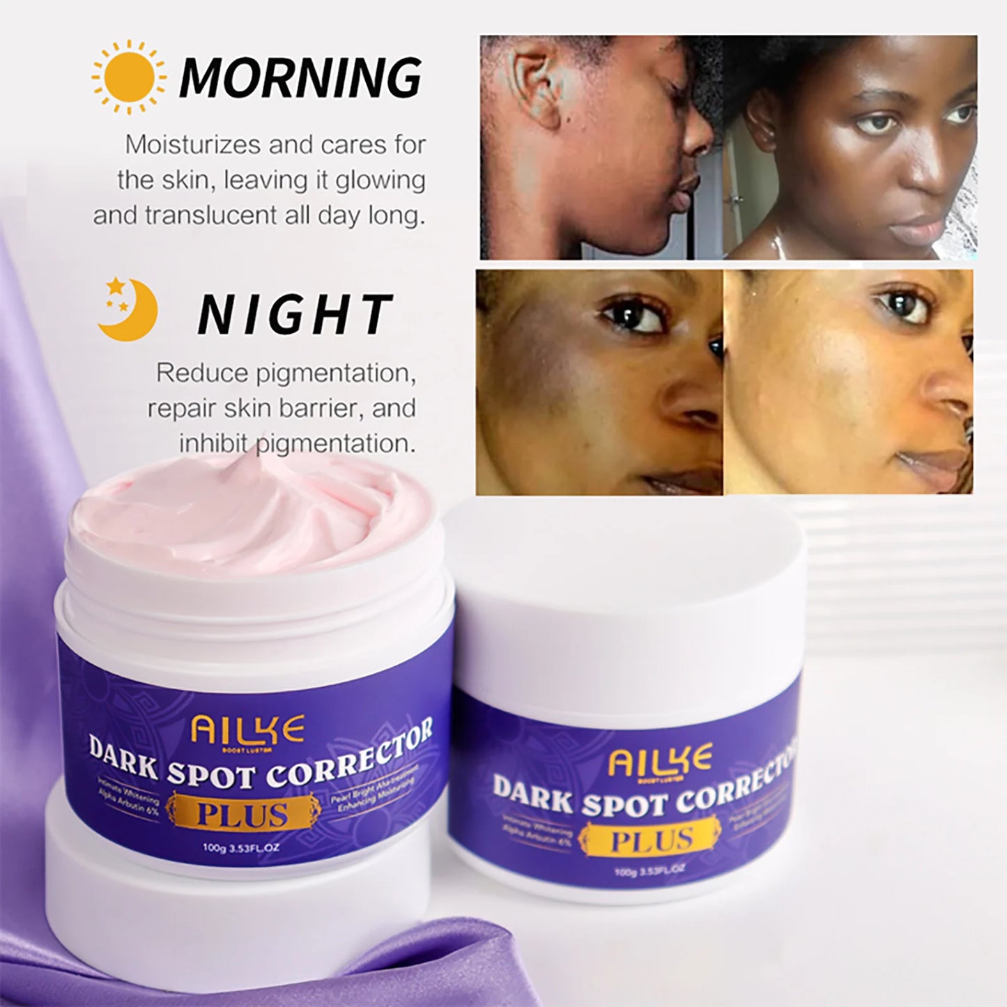 AILKE Dark Spot Remover for Face and Body Dark Spot Corrector for Age Spots Sun Spots Freckles Melasma and Brown Spots 100g