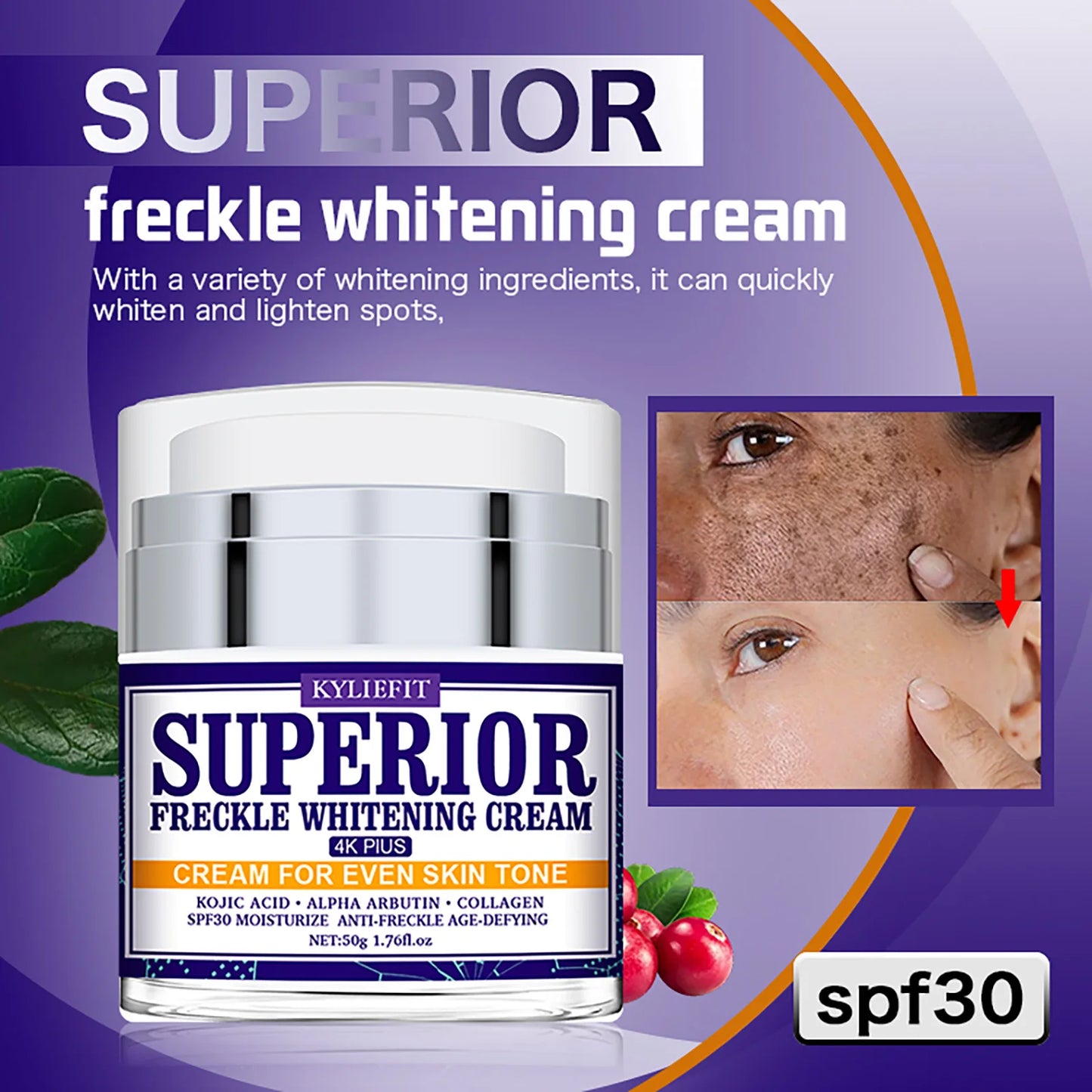 KYLIEFIT Superior Whitening Facial Cream for Freckles and Dark Spot Reduction Melanin Face Cream for All Skin Types