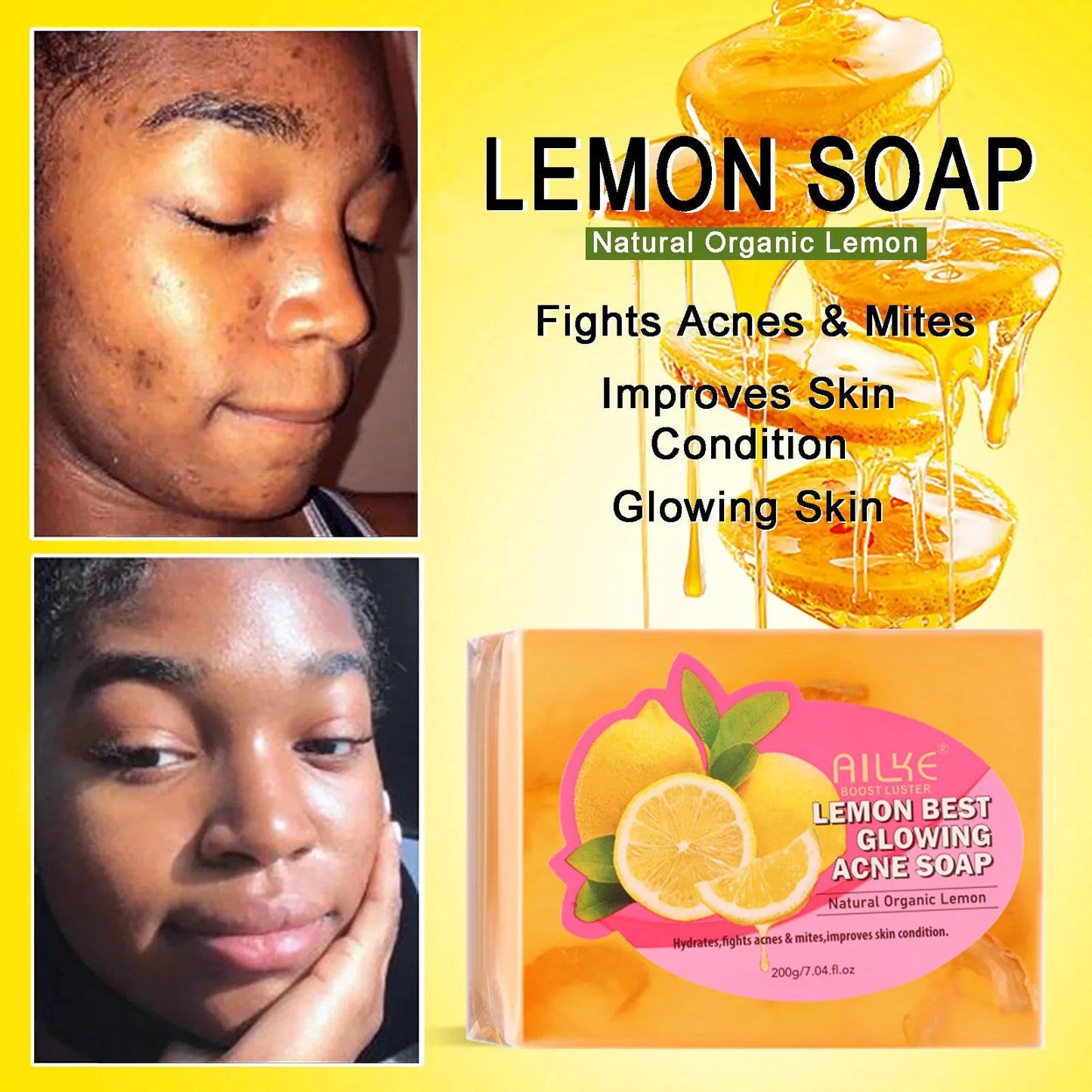 Ailke AHA Organic Skin Glowing Set Whitening Lotion Reduces Dark Spots Acne Cleansing Moisturizing for All Skin Types