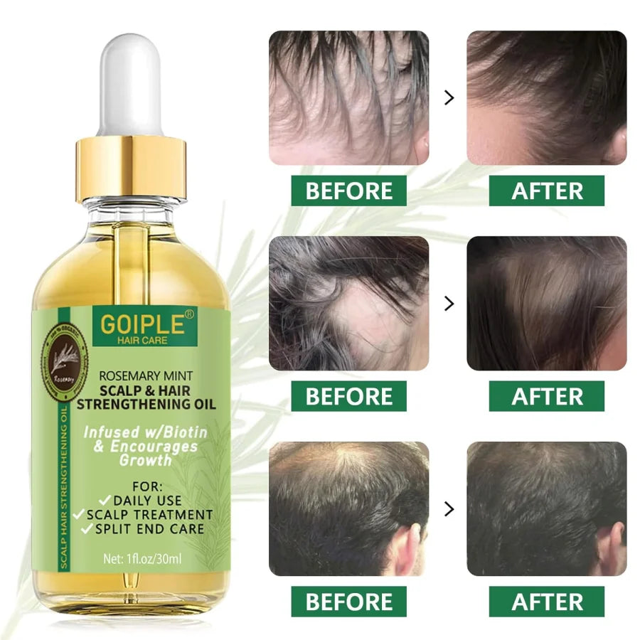 Hair Growth Serum Rosemary Mint Essential Oil for Dry Damaged Split Ends Anti Loss Treatment with Stainless Steel Tooth Comb
