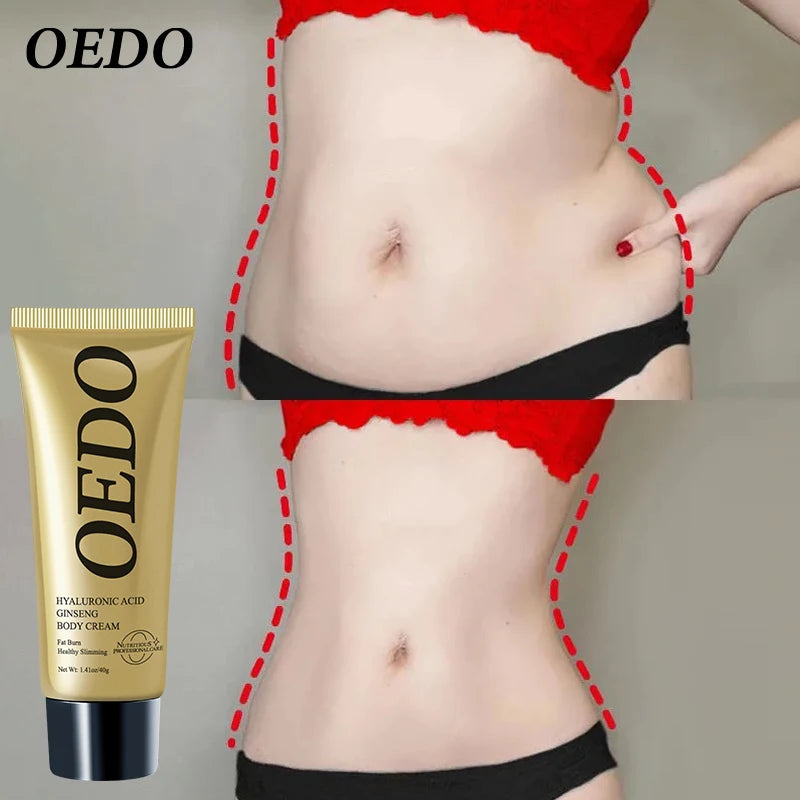 Slimming Cream Fat Burn Hyaluronic Body Cream Exercise Slimming Remove Cellulite Massage Firming Lifting Slim Fast Body Care