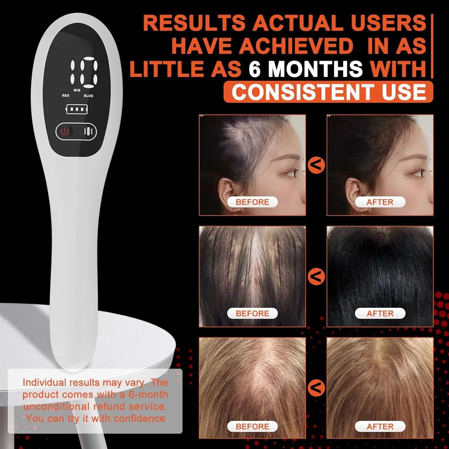 Electric Laser Hair Growth Comb Anti Hair Loss Therapy Infrared 650nm 470nm LED Red Light Vibration Massage Hair Care Brush