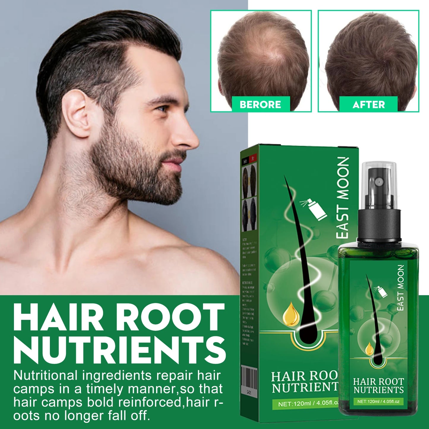 East Moon 120ml Men Hair Growth Spray Nourishing Root Fast Grow Anti Hair Loss Scalp Massage Care Repair Thickening Hair Spray