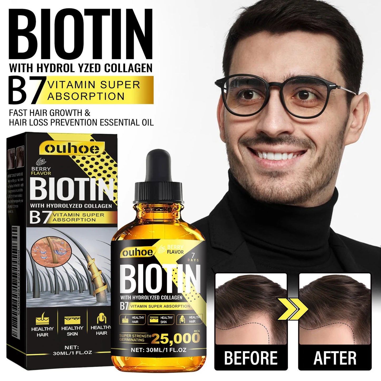 Ouhoe 30ml Collagen B7 Vitamin Hair Care Essential Oil Anti Hair Loss Moisture Repair Baldness Scalp Care Hair Growth Serum Oil