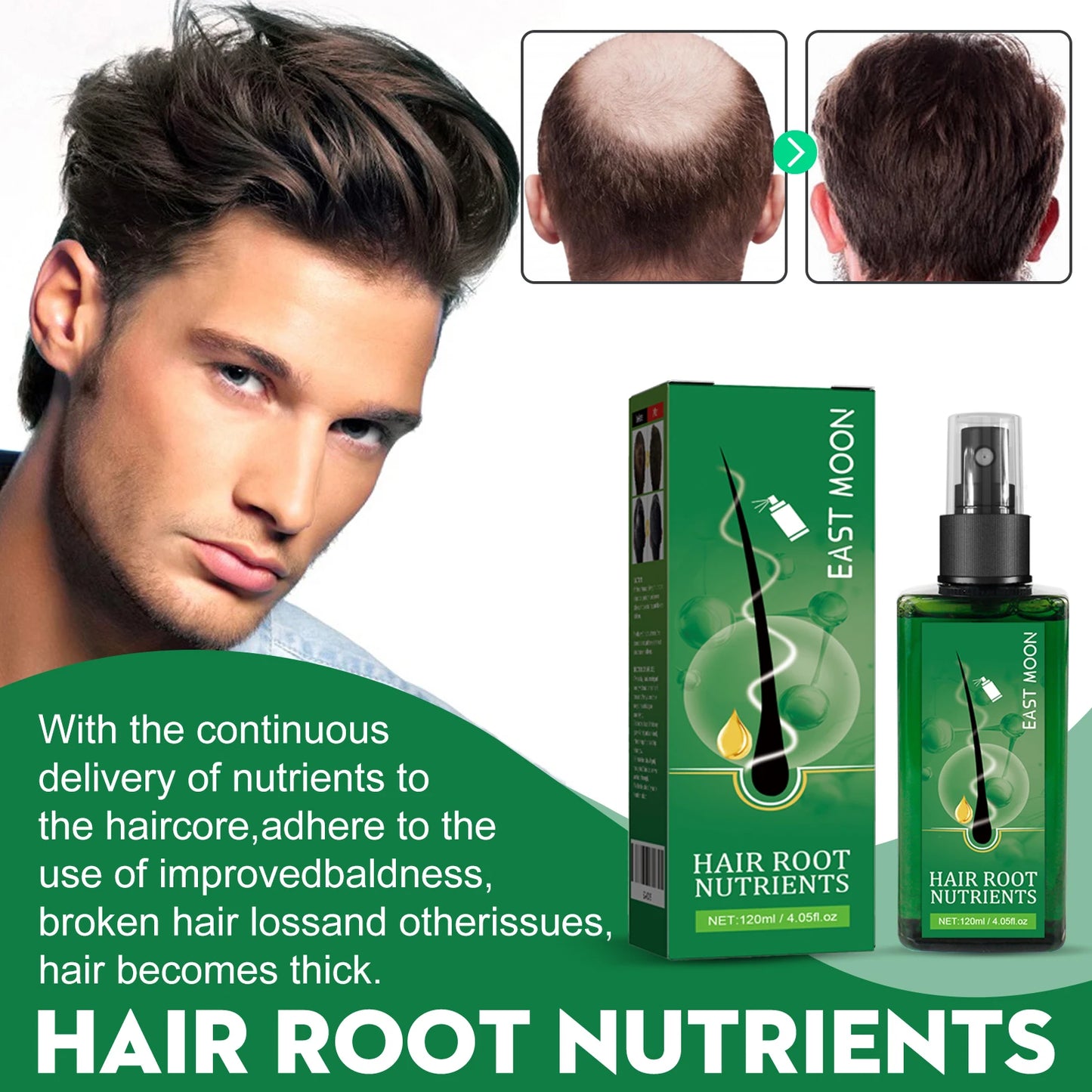 East Moon 120ml Men Hair Growth Spray Nourishing Root Fast Grow Anti Hair Loss Scalp Massage Care Repair Thickening Hair Spray