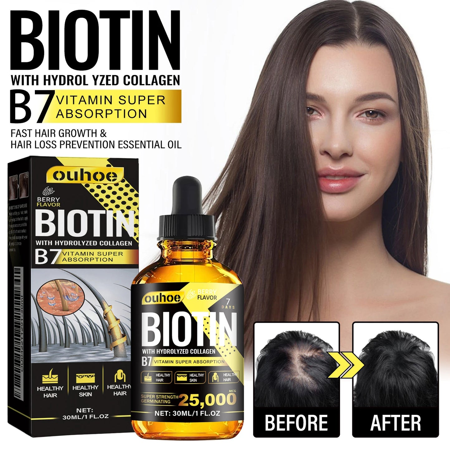 Ouhoe 30ml Collagen B7 Vitamin Hair Care Essential Oil Anti Hair Loss Moisture Repair Baldness Scalp Care Hair Growth Serum Oil