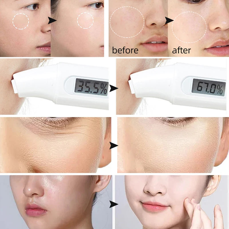 Spa Hydro Jelly Mask Powder with Hyaluronic Acid Rubber Petal Rose Peel Off Modeling Moisturizing Facial Mask for Dry Skin Care 650g