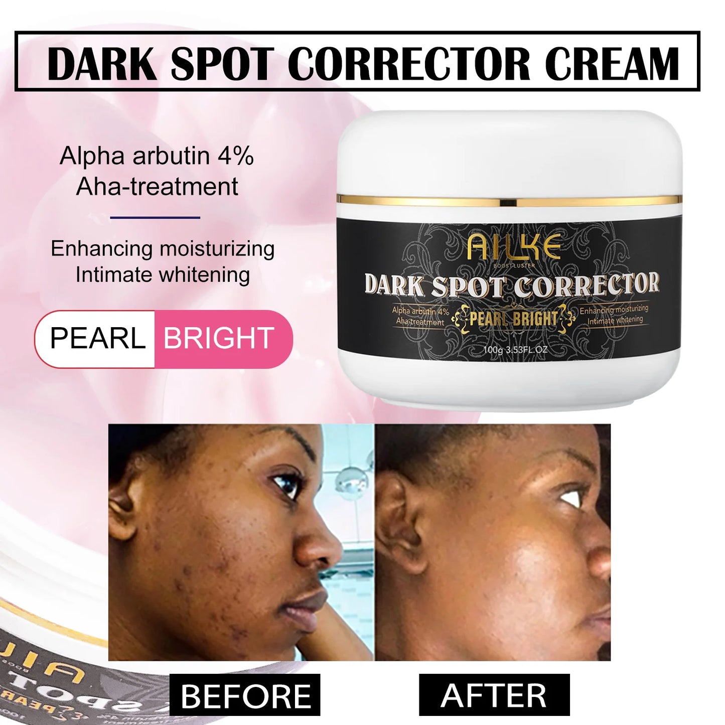 AILKE Dark Spot Corrector Cream for Face Body and Armpit with Organic Arbutin Intimate Whitening and Even Skin Tone Skincare