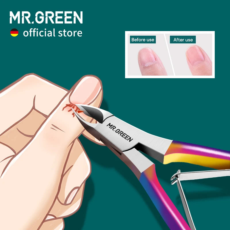 Mr Green Stainless Steel Cuticle Nippers Clippers Nail Manicure Scissors Trimmer Dead Skin Remover