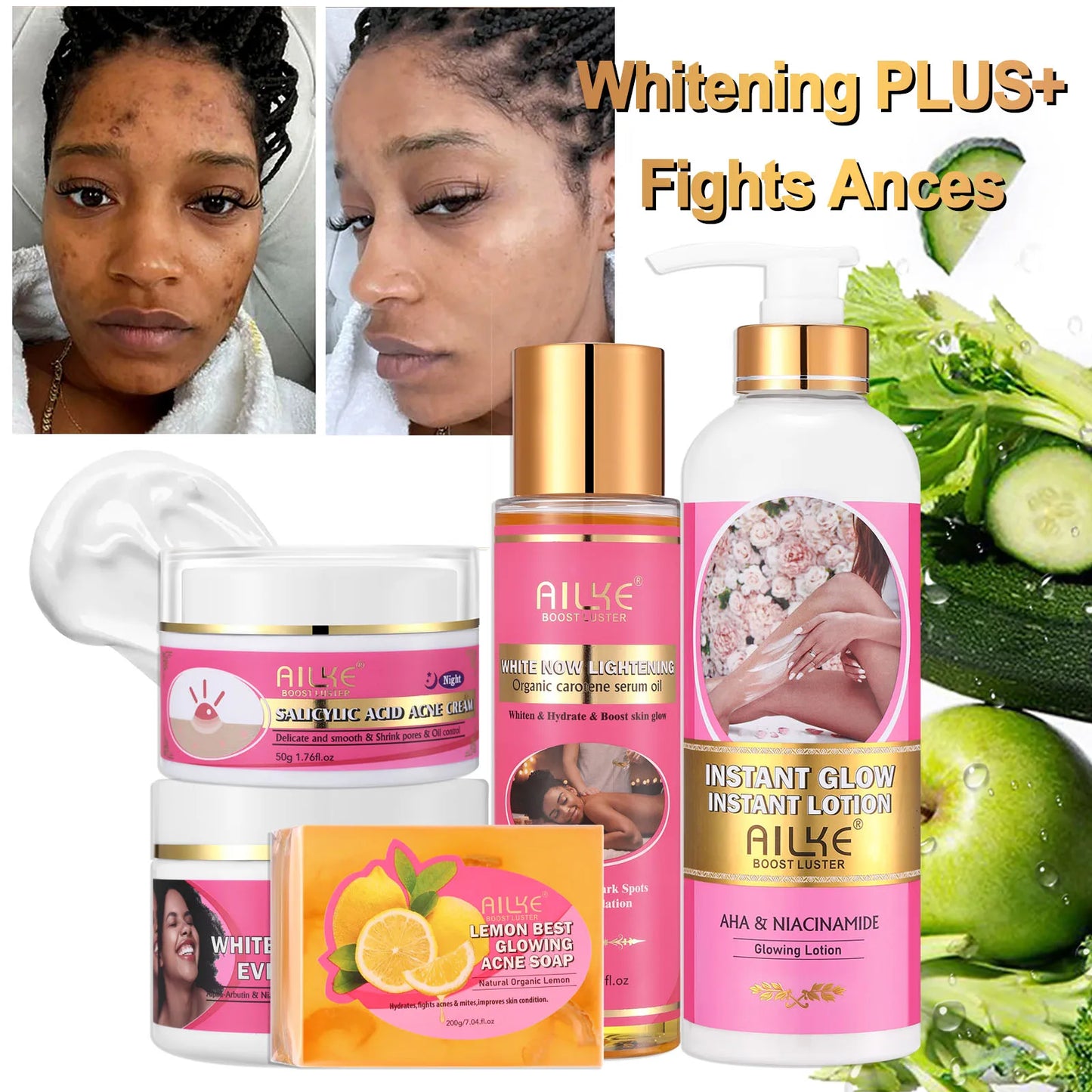 AILKE Clear Stubborn Acne Spots Cream Pimple Cream for Face and Body Lightening Body Lotion Vegan