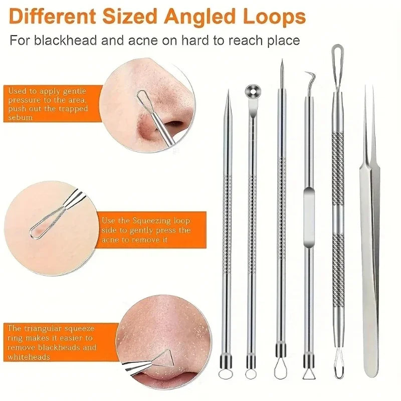 4Pcs Pimple Popper Tool Kit Blackhead Remover Acne Needle Tools Set Removing Care Whitehead Popping Acne Remover Skin Care Tools