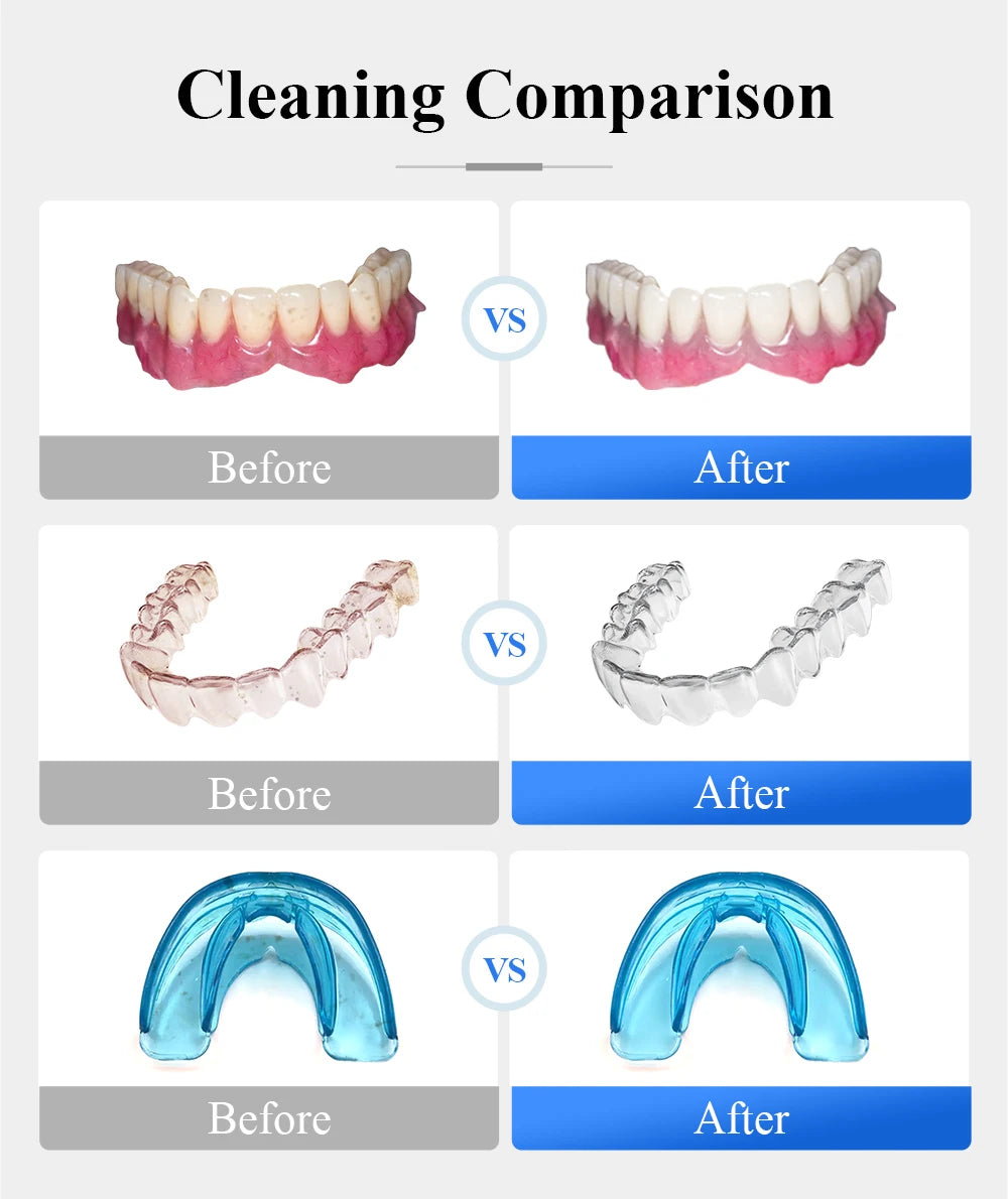 Tullker Household Ultrasonic Retainer Cleaner for Dentures Jewelry and Braces with UV Light 160ml