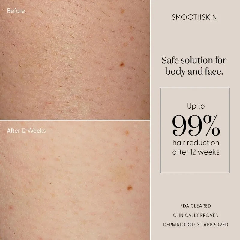 Smoothskin Pure Fit IPL Laser Hair Removal Device for Body and Face Long Lasting Hair Removal from Home with Precision Head