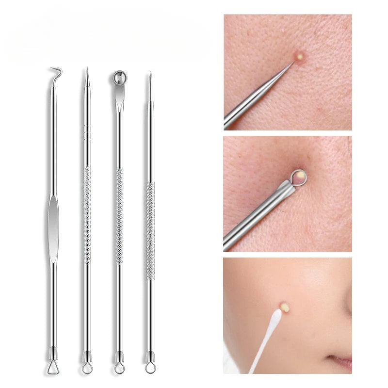 4Pcs Pimple Popper Tool Kit Blackhead Remover Acne Needle Tools Set Removing Care Whitehead Popping Acne Remover Skin Care Tools
